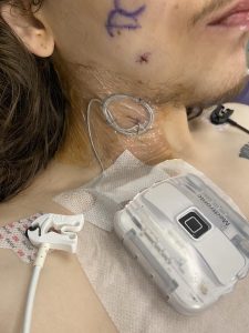 temporary implant